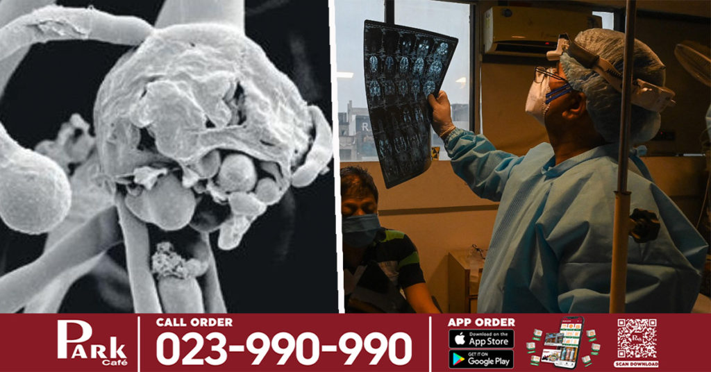 ប្រទេសឥណ្ឌាកត់ត្រាជំងឺផ្សិតខ្មៅ ឬ Black fungus ច្រើនជាង ៤៥,០០០ ករណី ក្នុងរយៈពេល ២ ខែកន្លងមកនេះ ហើយភាគច្រើនគឺកើតលើអ្នកជំងឺកូវីដ១៩