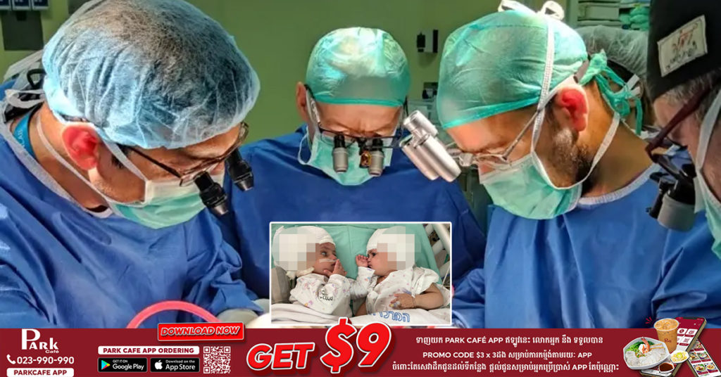 ទារិកាភ្លោះអាយុ ១ខួប ដែលមានក្បាលជាប់គ្នាពីកំណើត បានទទួលការវះកាត់យ៉ាងជោគជ័យជាលើកដំបូងបំផុត នៅក្នុងប្រតិបត្តិការវះកាត់ដ៏កម្រមួយនៅឯប្រទេសអ៊ីស្រាអែល