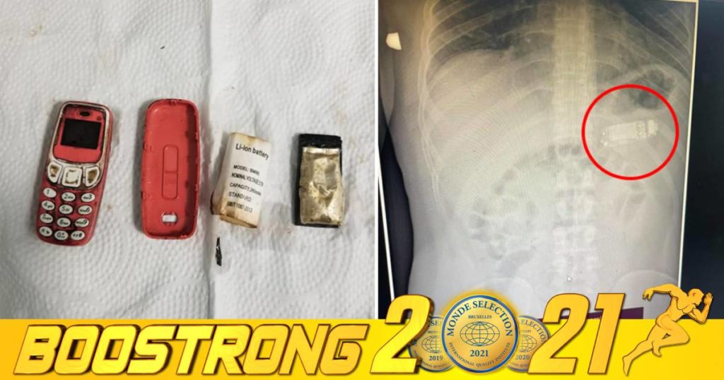 បុរសម្នាក់លេបទូរស័ព្ទ Nokia 3310 ចូលទៅក្នុងពោះ ខណៈខាងគ្រូពេទ្យចំណាយពេលរាប់ម៉ោងទើបអាចវះកាត់យកទូរស័ព្ទនោះចេញមកវិញបាន