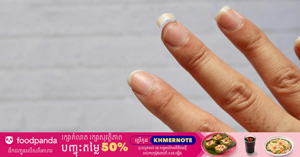 រោគសញ្ញា ១០ យ៉ាង​​ បង្ហាញថាយើង​កំពុងខ្វះវីតាមីន C