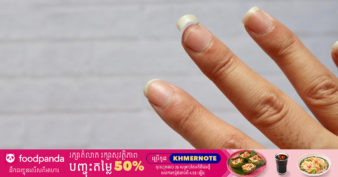 រោគសញ្ញា ១០ យ៉ាង​​ បង្ហាញថាយើង​កំពុងខ្វះវីតាមីន C