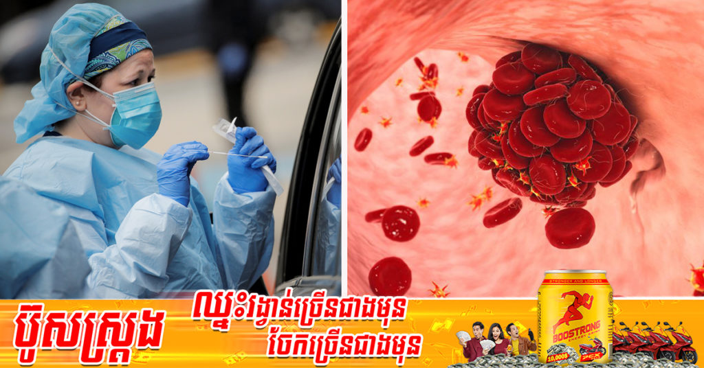 ការសិក្សាថ្មីមួយបានបង្ហាញថា ជំងឺកូវីដ១៩ បង្កើនហានិភ័យវិវត្តទៅជាមានបញ្ហាឈាមកកធ្ងន់ធ្ងររហូតដល់ទៅ ៦ខែ បន្ទាប់ពីឆ្លងជំងឺនេះរួច