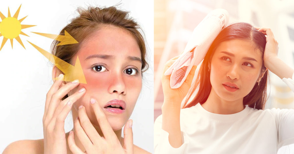 ក្បួនថែរក្សាស្បែកទាំង ៦ចំណុច ក្នុងរដូវក្តៅ ការពារស្បែកបានល្អ មិនខូចមិនព្រួយបារម្ភ