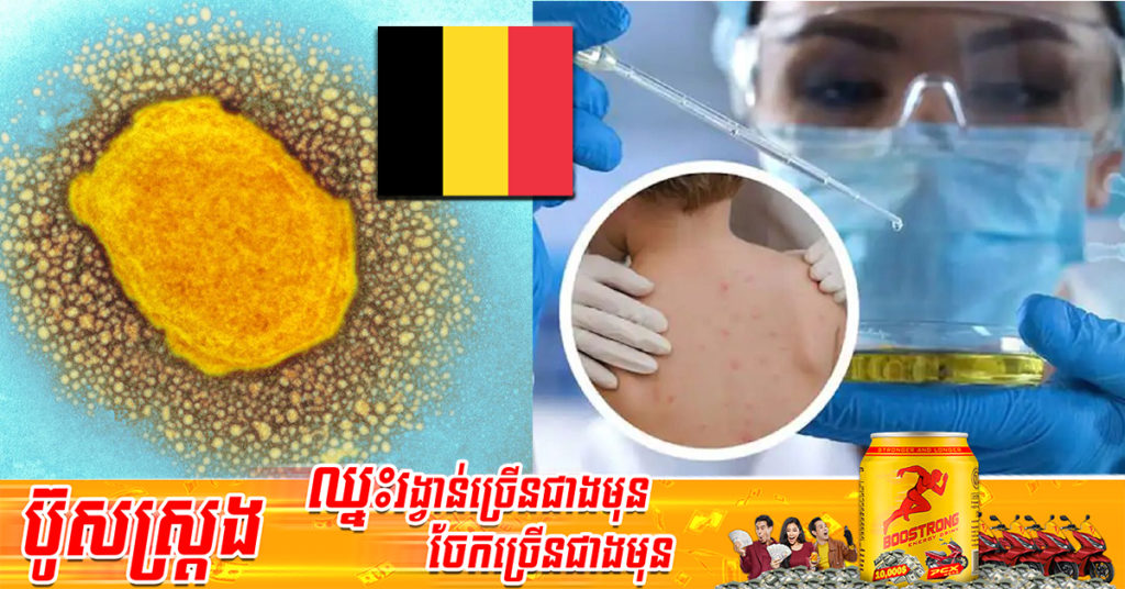 បែលហ្ស៊ិក ក្លាយជាប្រទេសដំបូងគេដែលតម្រូវឱ្យអ្នកឆ្លងជំងឺអុតស្វា ត្រូវដាក់ឱ្យនៅដាច់ដោយឡែករយៈពេល ២១ ថ្ងៃ