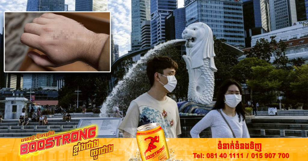 សិង្ហបុរីបាន​បញ្ជាក់​រកឃើញករណី​ជំងឺអុតស្វា monkeypox ដំបូង លើបុរសជនជាតិអង់គ្លេសម្នាក់ ដែលជាអ្នកបម្រើការនៅលើយន្តហោះ