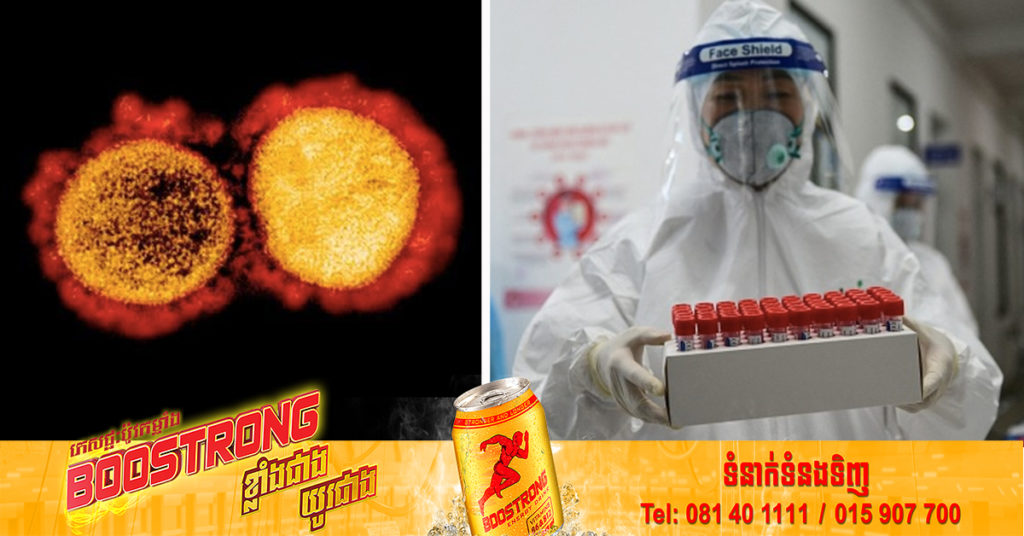 ម៉ាឡេស៊ីបានរកឃើញវត្តមាននៃជំងឺកូវីដ១៩ វ៉ារ្យ៉ង់អូមីក្រុងបំប្លែងរងចំនួន ២ ប្រភេទ គឺ BA.5 និង BA.2.12.1