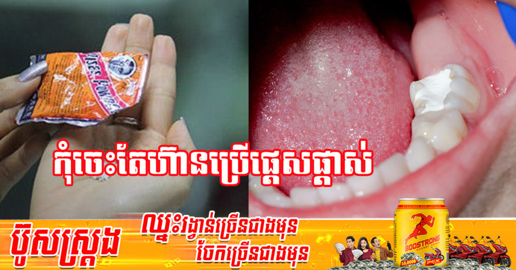 ឱសថការីថៃព្រមានកុំអោយប្រើម្ស៉ៅបែបនេះមកបិទធ្មេញប្រហោង ដូចវីដេអូគេចែកចាយក្នុង TikTok ព្រោះអាចប៉ះពាល់ដល់អាយុជីវិត