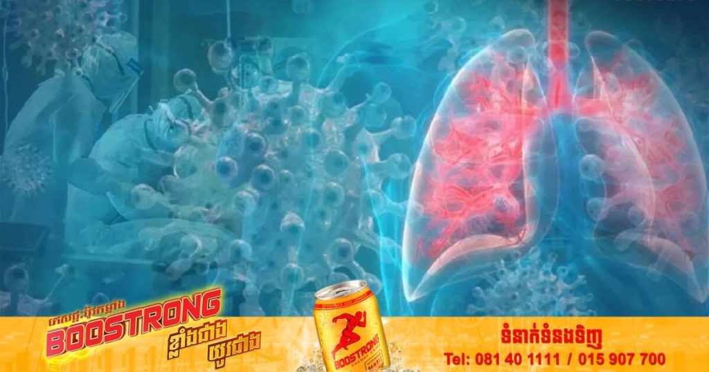 អ្នកជំនាញថៃម្នាក់អះអាងថា អូមីក្រុងអាចនឹងមិនធ្ងន់ធ្ងរនោះទេ តែការវ៉ាក់សាំងនៅតែចាំបាច់ដើម្បីការពារអាយុជីវិត