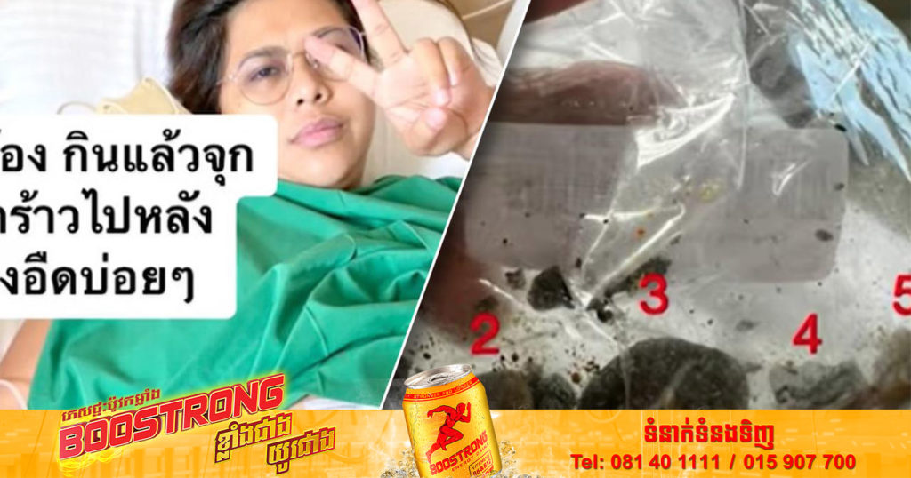 អ្នកចូលចិត្តញ៉ាំអាហារប្រភេទនេះត្រូវ​ប្រយ័ត្ន ក្រោយស្ត្រីជនជាតិថៃម្នាក់ រក​ឃើញ​គ្រួស​ក្នុង​ថង់​ទឹក​ប្រមាត់ចំនួន ៥​ដុំ ព្រមទាំងចេញសារដាស់តឿន ប្រសិនបើមានរោគសញ្ញាទាំងនេះ