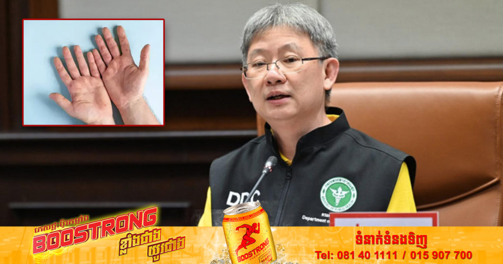 ថៃបានប្រកាសថា ប្រទេសខ្លួនគ្មានការផ្ទុះឡើងនៃជំងឺផ្តាសាយប៉េងប៉ោះទេ ហើយវាក៏មិនមែនជាជំងឺថ្មីថ្មោងដែរ