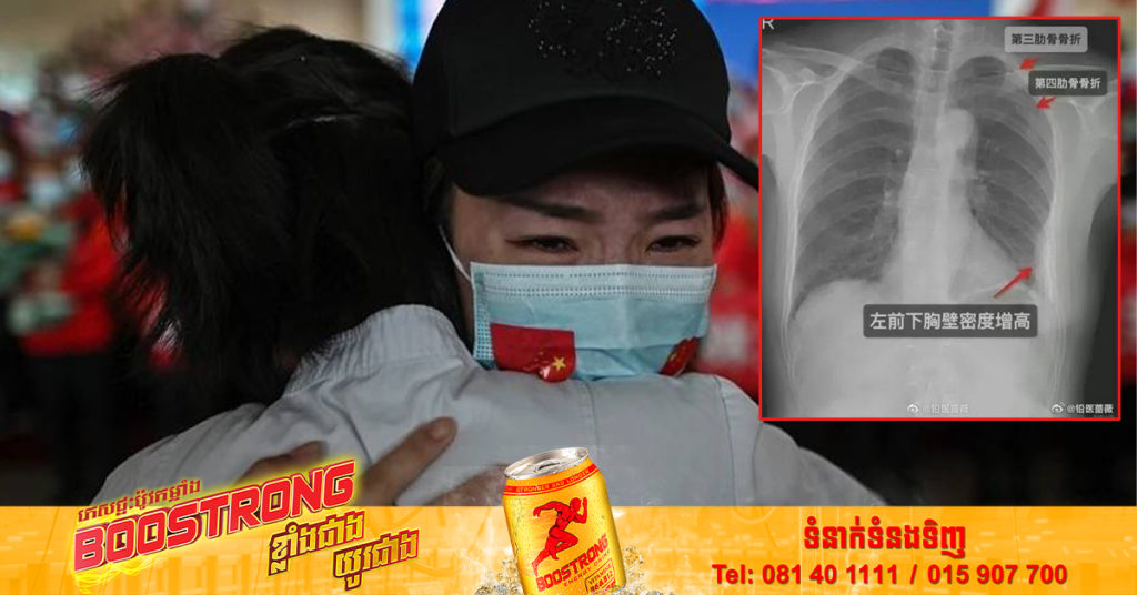 ស្ត្រីម្នាក់នៅចិនដាក់ពាក្យប្តឹងទៅតុលាការ ក្រោយត្រូវមិត្តរួមការងារឱបខ្លាំងពេក ធ្វើ​ឱ្យបាក់​ឆ្អឹងជំនី​៣​កង់