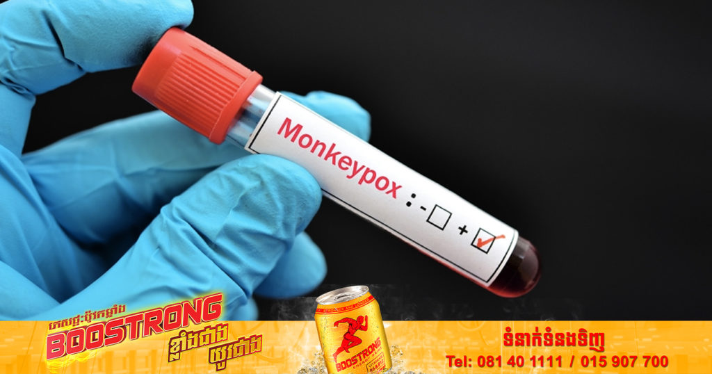 សហរដ្ឋអាមេរិកឥឡូវនេះ មានករណីជំងឺអុតស្វា monkeypox នៅទូទាំងរដ្ឋទាំង ៥០ របស់ខ្លួន