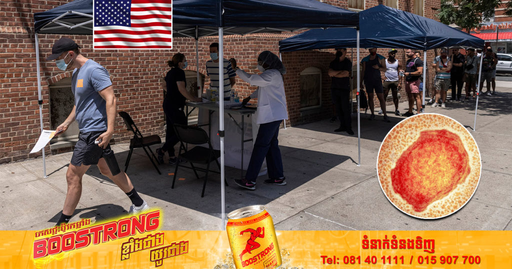 សហរដ្ឋអាមេរិករកឃើញអ្នកបាត់បង់ជីវិត ដោយសារជំងឺអុតស្វា Monkeypox ករណីទី ២