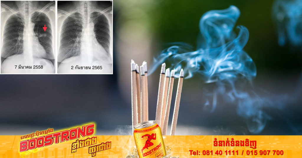 បងប្អូនដែលឧស្សាហ៍អុជធូបគួរតែប្រយ័ត្ន! ស្ត្រីជនជាតិថៃម្នាក់រកឃើញថា ខ្លួនកើតជំងឺមហារីកសួត ដោយសារតែស្រូបផ្សែងធូប ដែលអុជរាល់ថ្ងៃ អស់រយៈពេលជាង៦ឆ្នាំ