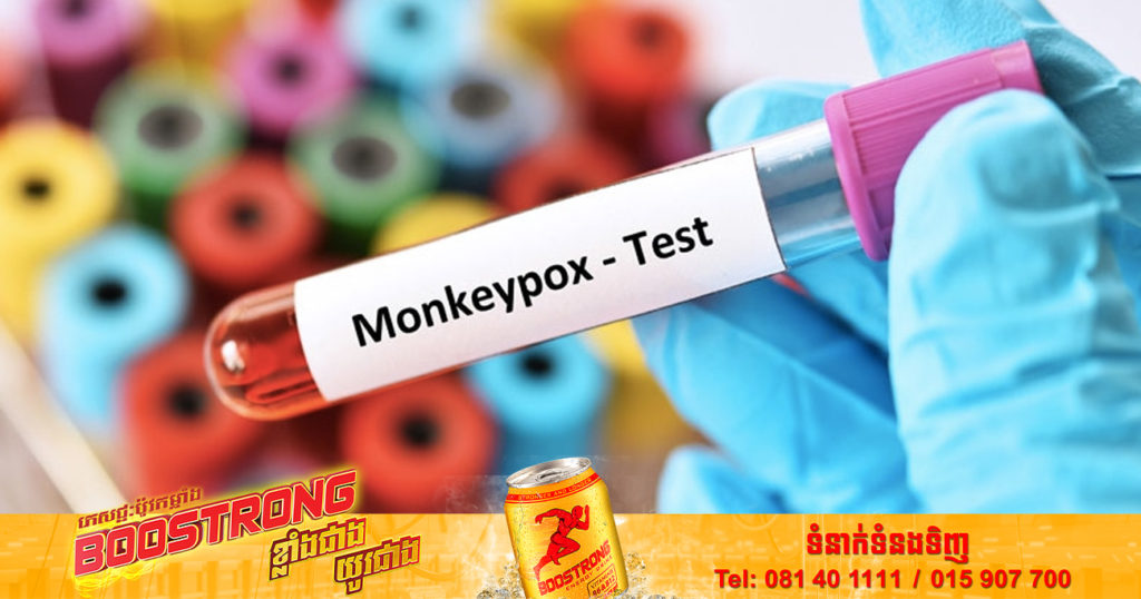 នាយកដ្ឋានសុខភាពសាធារណៈ Los Angeles បញ្ជាក់ពីករណីមរណភាពដំបូង ដោយសារជំងឺអុតស្វា Monkeypox