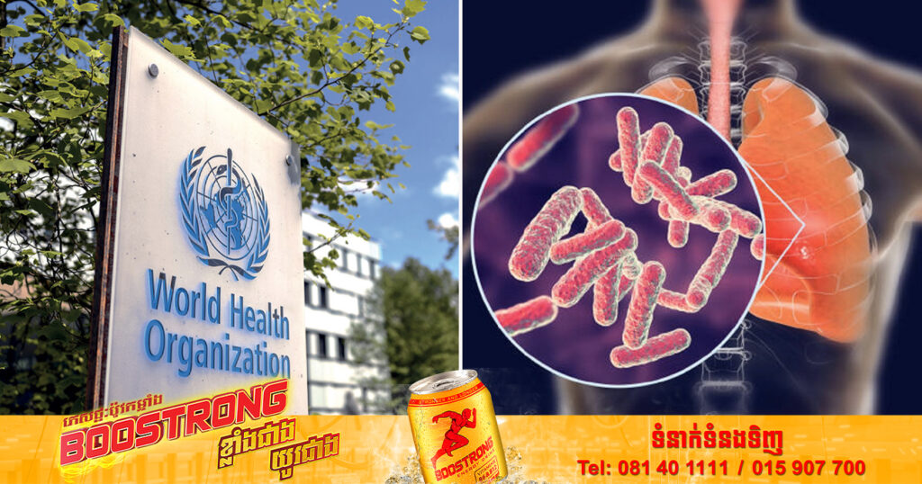 WHO បាននិយាយថា ជំងឺរបេងមានការកើនឡើងក្នុងរយៈពេល ២ ឆ្នាំចុងក្រោយនេះ បន្ទាប់ពីការធ្លាក់ចុះជាច្រើនឆ្នាំ