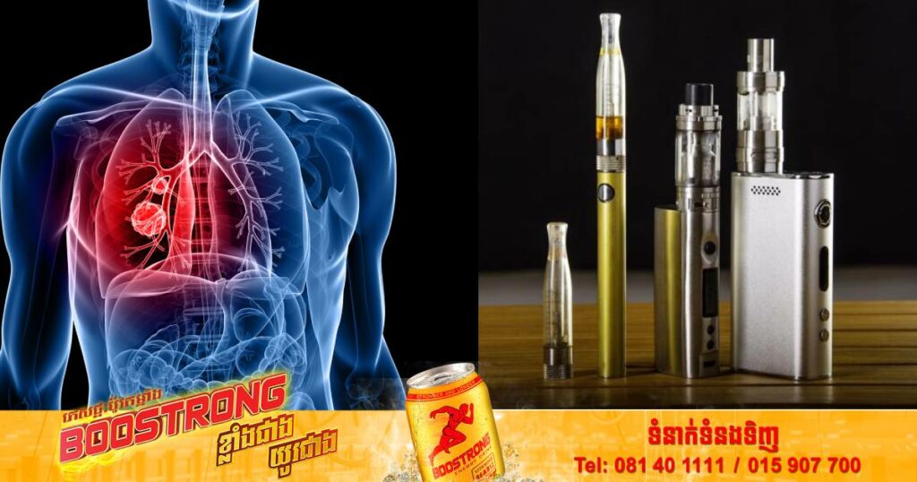 ថៃប្រកាសរកឃើញជាលើកដំបូងនៃករណីអ្នកកើតជំងឺ “Evali” ដែលជាជំងឺរលាកសួតធ្ងន់ធ្ងរបង្កឡើងដោយការជក់បារីអេឡិចត្រូនិច