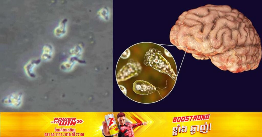 កូរ៉េខាងត្បូងរកឃើញអ្នកឆ្លងមេរោគ Naegleria fowleri ដែលជាមេរោគស៊ីខួក្បាលអ្នកជំងឺរហូតដល់បាត់បង់ជីវិតជាលើកដំបូង