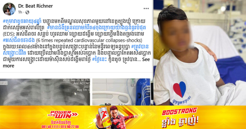 សំណាងមួយ លើ១ម៉ឺនករណី! កុមារាម្នាក់ មានជំងឺគ្រុនឈាមកម្រិត ៤ចុងក្រោយ បញ្ជូនមកមន្ទីរពេទ្យគន្ធបុប្ផា ត្រូវបានក្រុមគ្រូពេទ្យសង្គ្រោះទាន់ពេល