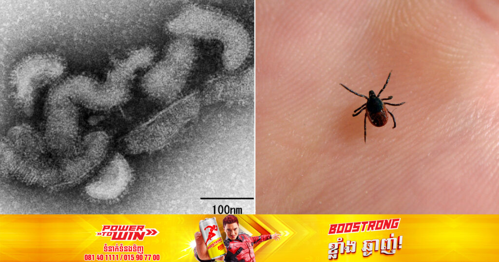 ជប៉ុនបានប្រកាសពីករណីមរណភាពដំបូងរបស់ពិភពលោក ពាក់ព័ន្ធនឹង Oz virus ដែលជាមេរោគមាននៅលើចៃឆ្កែ