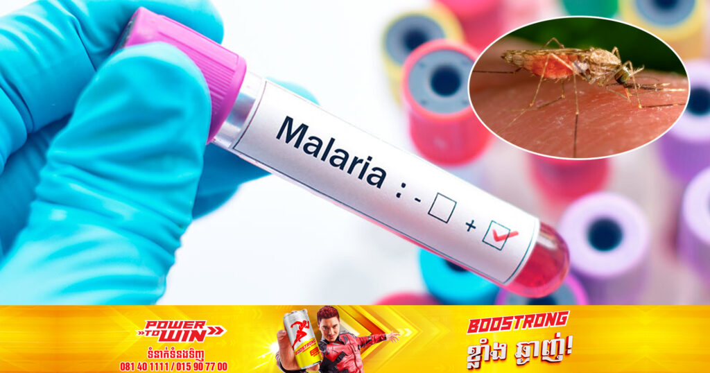 សហរដ្ឋអាមេរិកបានរកឃើញករណីជំងឺគ្រុនចាញ់ជាលើកដំបូងបំផុត ក្នុងរយៈពេល ២០ ឆ្នាំចុងក្រោយនេះ