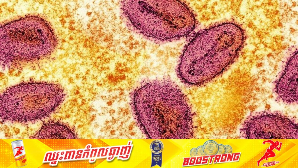 ហ្វីលីពីន ប្រកាសរកឃើញករណីអ្នកឆ្លងជំងឺអុតស្វាជាលើកដំបូង សម្រាប់នៅក្នុងឆ្នាំ ២០២៤នេះ