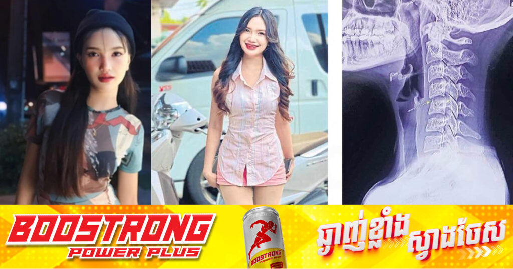 តារាចម្រៀងថៃស្រីម្នាក់បាត់បង់ជីវិតទាំងវ័យក្មេង ក្រោយទទួលសេវាកម្មម៉ាស្សាស្មា និងកញ្ចឹងក ខណៈអ្នកជំនាញព្រមានឱ្យមានការប្រុងប្រយ័ត្ន