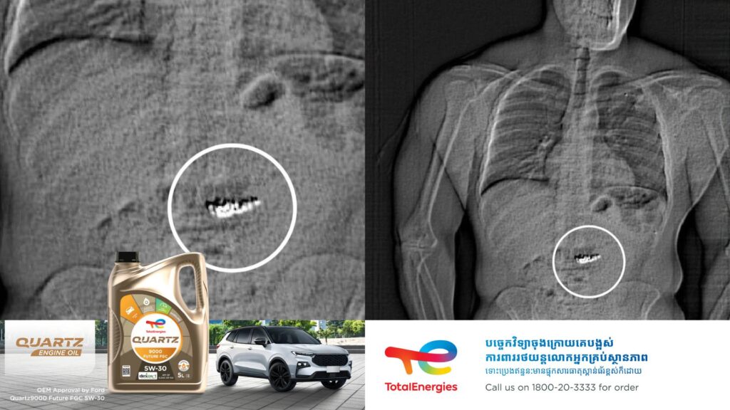 ថ្មីទៀតហើយ! នៅអាមេរិក បុរសជាចោរម្នាក់ បន្លំលេបក្រវិលពេជ្រតម្លៃ ៧៧ម៉ឺនដុល្លារចូលទៅក្នុងពោះ